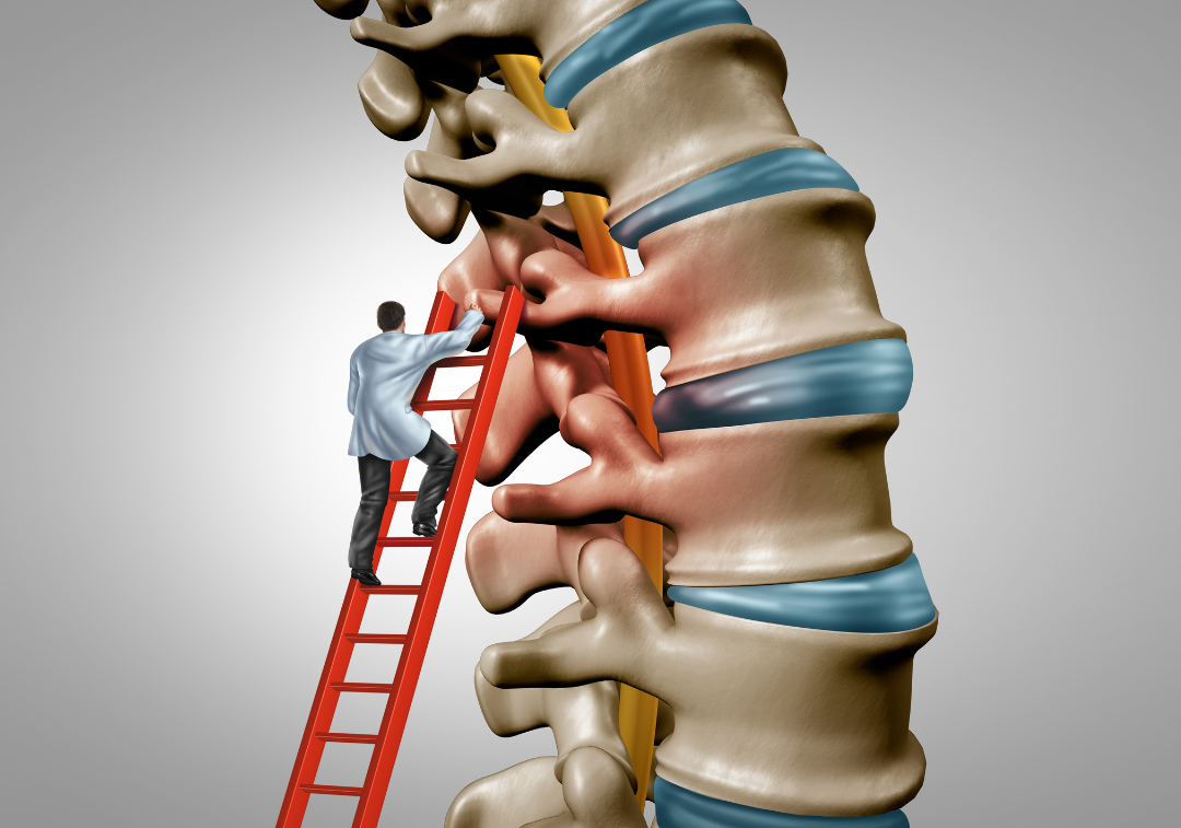 Class 4 high power laser