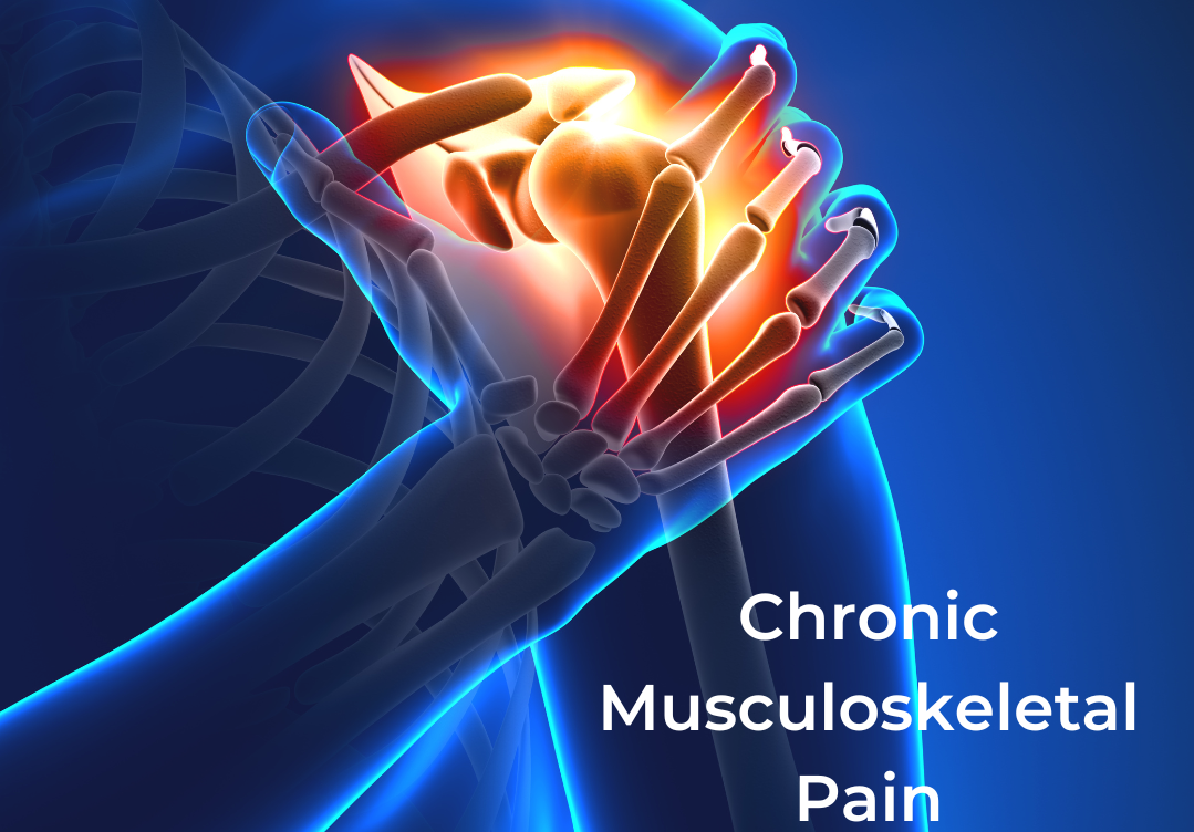 Class 4 high power laser